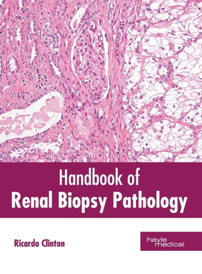 Handbook of Renal Biopsy Pathology by Ricardo Clinton - Hardback