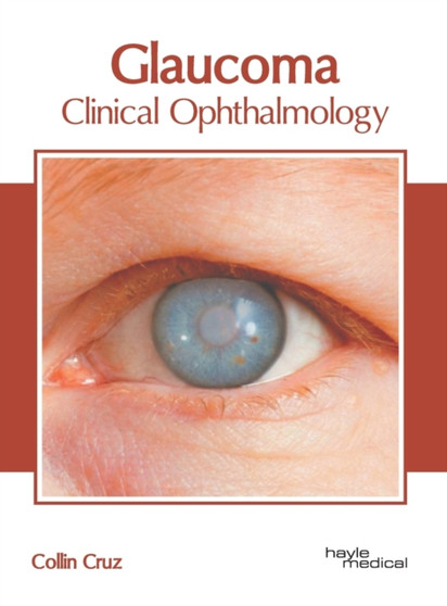 Glaucoma: Clinical Ophthalmology by Collin Cruz - Hardback