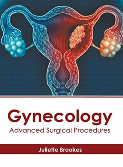 Gynecology: Advanced Surgical Procedures by Juliette Brookes - Hardback