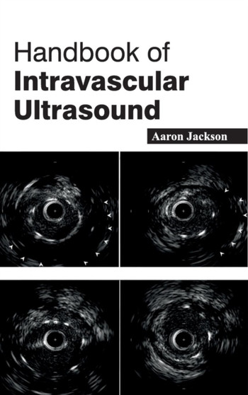 Handbook of Intravascular Ultrasound by Aaron Jackson - Hardback