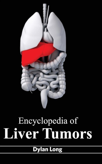 Encyclopedia of Liver Tumors by Dylan Long - Hardback
