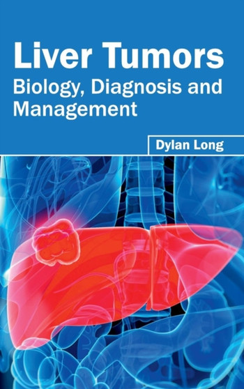 Liver Tumors: Biology, Diagnosis and Management by Dylan Long - Hardback