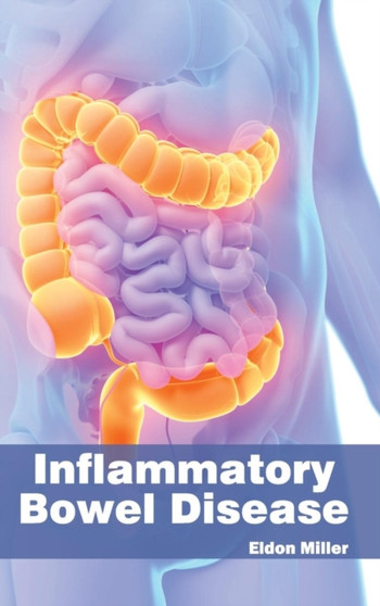 Inflammatory Bowel Disease by Eldon Miller - Hardback