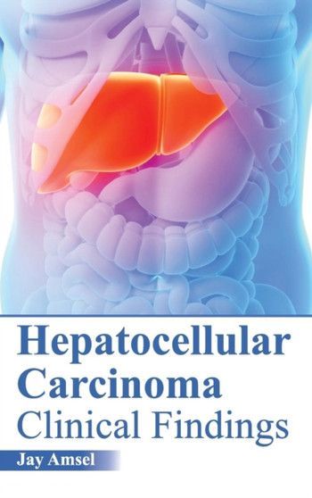 Hepatocellular Carcinoma: Clinical Findings by Jay Amsel - Hardback