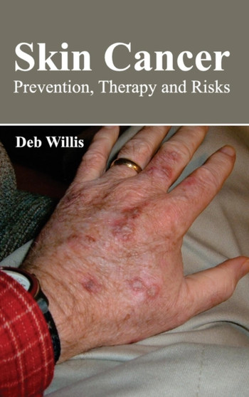 Skin Cancer: Prevention, Therapy and Risks by Deb Willis - Hardback