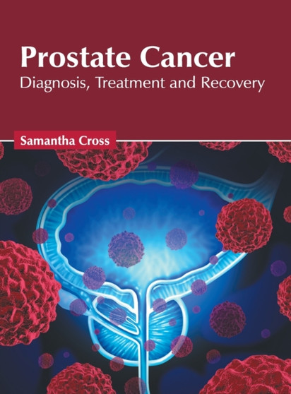 Prostate Cancer: Diagnosis, Treatment and Recovery by Samantha Cross - Hardback
