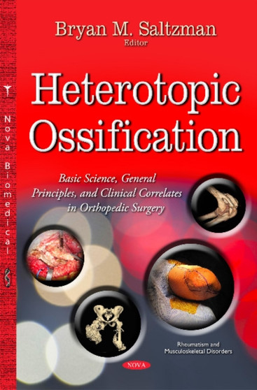 Heterotopic Ossification : Basic Science, General Principles & Clinical Correlates in Orthopedic Surgery by Bryan M M.D. Saltzman - Hardback