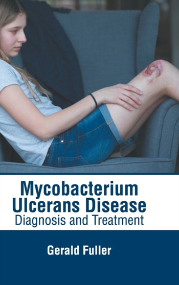Mycobacterium Ulcerans Disease: Diagnosis and Treatment by Gerald Fuller - Hardback