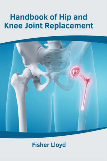 Handbook of Hip and Knee Joint Replacement by Fisher Lloyd - Hardback