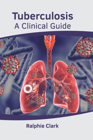Tuberculosis: A Clinical Guide by Ralphie Clark - Hardback