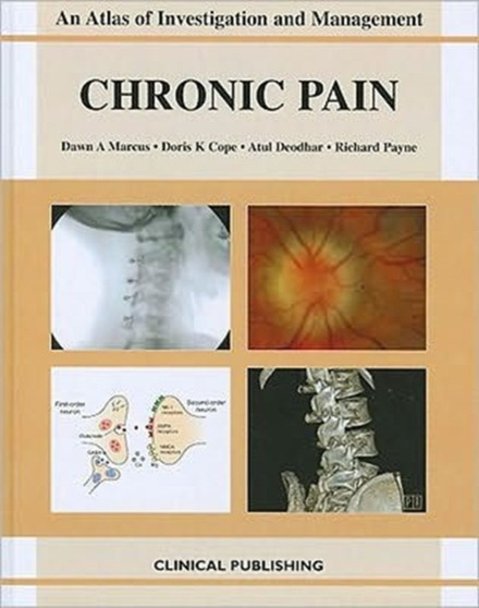 Chronic Pain by Dawn A. Marcus - Hardback