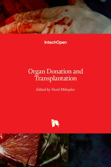 Organ Donation and Transplantation by Vassil Mihaylov - Hardback