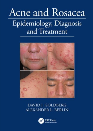 Acne and Rosacea : Epidemiology, Diagnosis and Treatment by David Goldberg - Hardback
