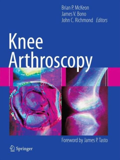 Knee Arthroscopy by Brian McKeon - Paperback