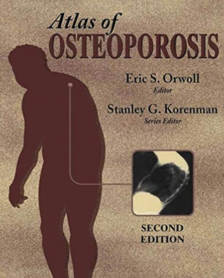 Atlas of Osteoporosis by Stanley G. Korenman - Paperback