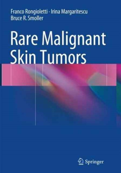 Rare Malignant Skin Tumors by Franco Rongioletti - Paperback
