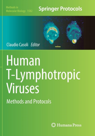 Human T-Lymphotropic Viruses : Methods and Protocols : 1582 by Claudio Casoli - Paperback