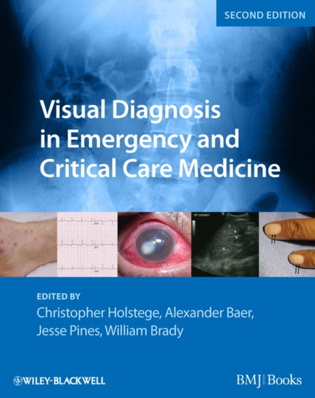 Visual Diagnosis in Emergency and Critical Care Medicine by Christopher P. Holstege - Paperback