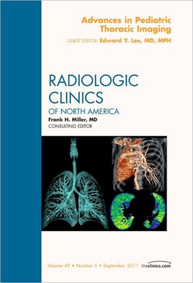 Advances in Pediatric Thoracic Imaging, An Issue of Radiologic Clinics of North America : Volume 49-5 by Edward Y MD MPH Lee - Hardback