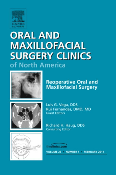 Reoperative Oral and Maxillofacial Surgery, An Issue of Oral and Maxillofacial Surgery Clinics : Volume 23-1 by Rui Fernandes - Hardback