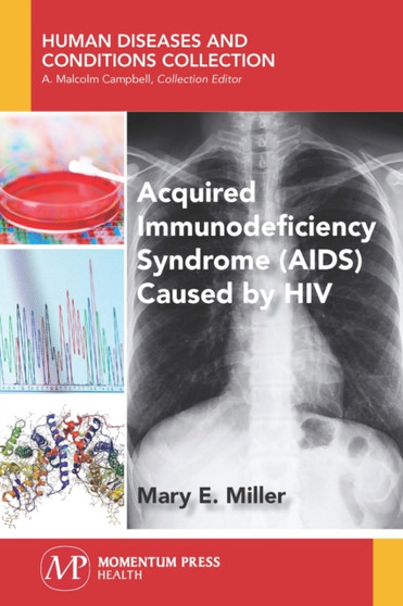 Acquired Immunodeficiency Syndrome (AIDS) Caused by HIV by Mary E. Miller - Paperback