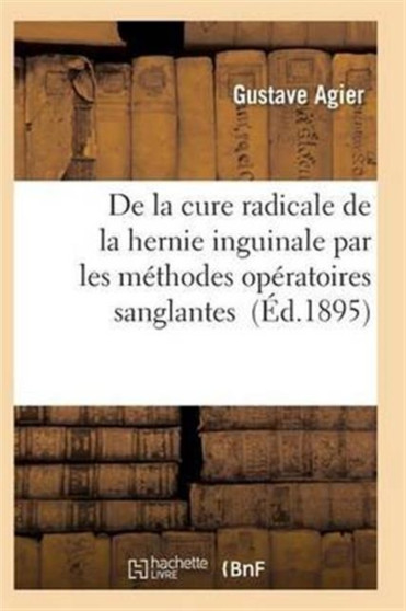 de la Cure Radicale de la Hernie Inguinale Par Les Methodes Operatoires Sanglantes by Agier-G - Paperback