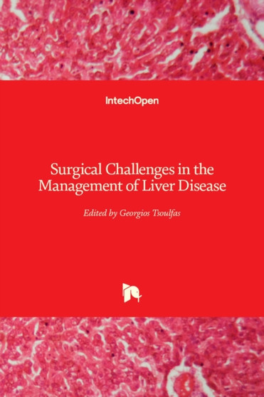 Surgical Challenges in the Management of Liver Disease by Georgios Tsoulfas - Hardback