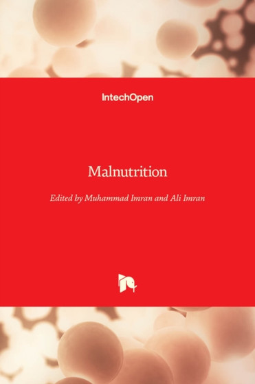 Malnutrition by Muhammad Imran - Hardback