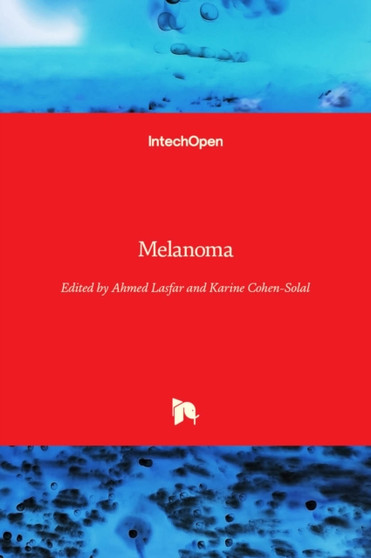 Melanoma by Ahmed Lasfar - Hardback