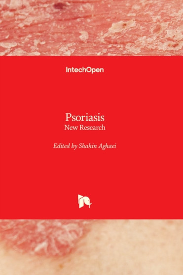 Psoriasis : New Research by Shahin Aghaei - Hardback