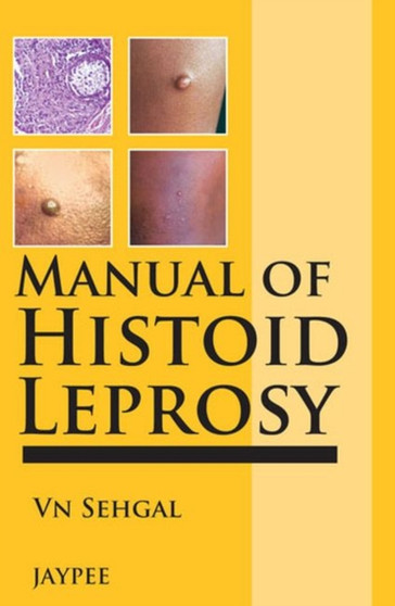 Manual of Histoid Leprosy by Virendra N Sehgal - Paperback