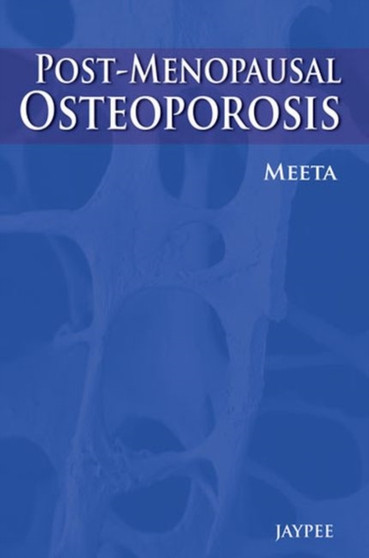 Post-Menopausal Osteoporosis by Meeta - Hardback