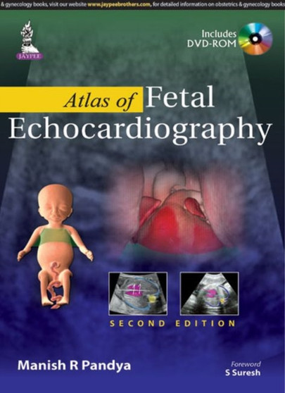 Atlas of Fetal Echocardiography by Manish R Pandya - Hardback