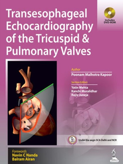 Transesophageal Echocardiography of the Tricuspid & Pulmonary Valves by Poonam Malhotra Kapoor - Hardback