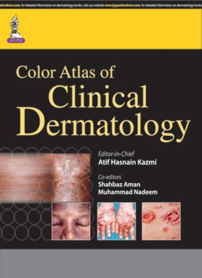 Color Atlas of Clinical Dermatology by Atif Hasnain Kazmi - Paperback