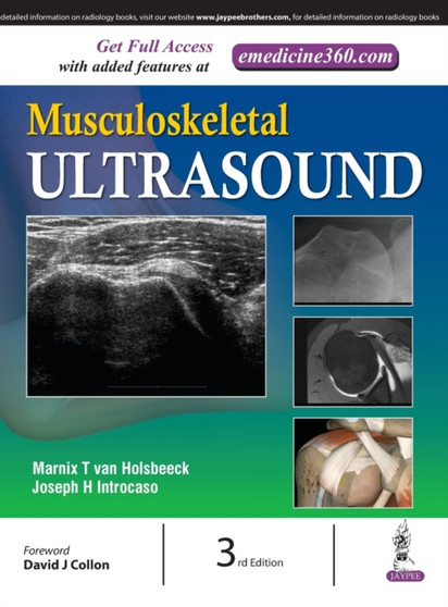 Musculoskeletal Ultrasound by van Holsbeeck Marnix - Hardback