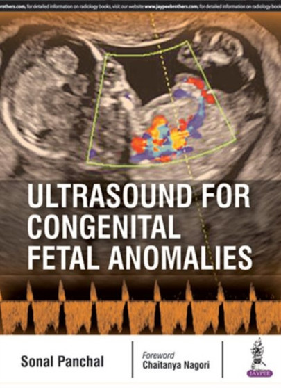 Ultrasound for Congenital Fetal Anomalies by Sonal Panchal - Paperback