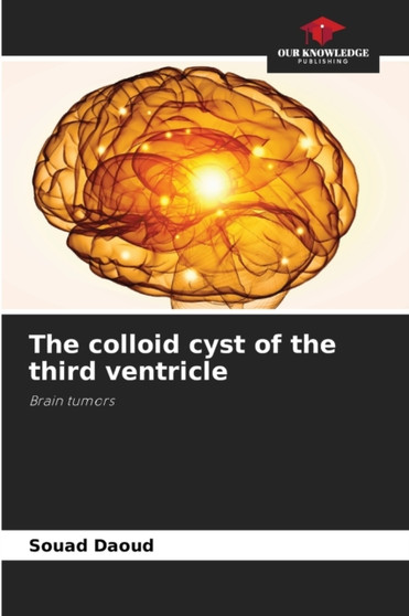 The colloid cyst of the third ventricle by Souad Daoud - Paperback