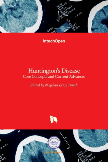 Huntington's Disease : Core Concepts and Current Advances by Nagehan Ersoy Tunali - Hardback