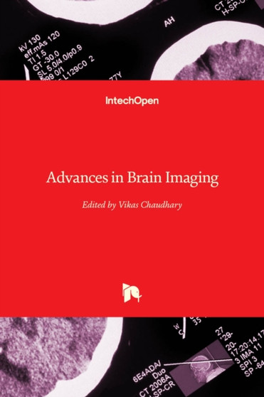 Advances in Brain Imaging by Vikas Chaudhary - Hardback