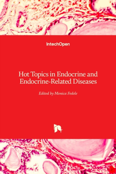 Hot Topics in Endocrine and Endocrine-Related Diseases by Monica Fedele - Hardback