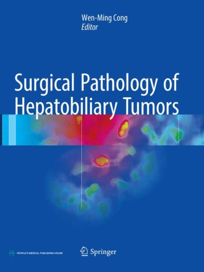 Surgical Pathology of Hepatobiliary Tumors by Wen-Ming Cong - Paperback