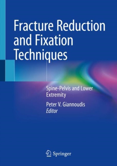 Fracture Reduction and Fixation Techniques : Spine-Pelvis and Lower Extremity by Peter V. Giannoudis - Paperback