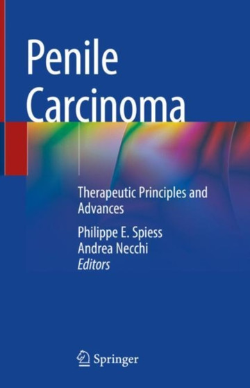 Penile Carcinoma : Therapeutic Principles and Advances by Philippe E. Spiess - Hardback