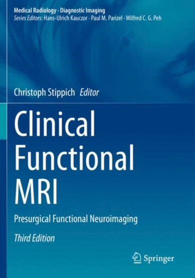 Clinical Functional MRI : Presurgical Functional Neuroimaging by Christoph Stippich - Paperback