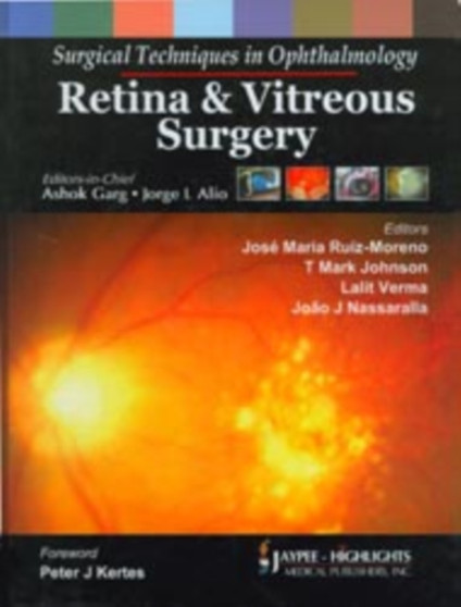 Surgical Techniques in Ophthalmology: Retina and Vitreous Surgery by Ashok Garg - Hardback
