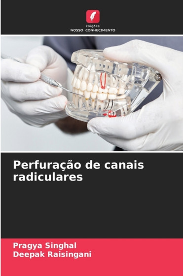 Perfuracao de canais radiculares by Pragya Singhal - Paperback