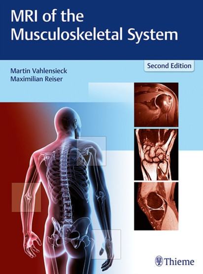 MRI of the Musculoskeletal System by Martin Vahlensieck - Hardback