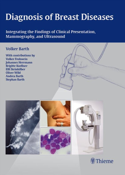Diagnosis of Breast Diseases : Integrating the Findings of Clinical Presentation, Mammography, and Ultrasound by Volker Barth - Hardback