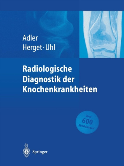 Radiologische Diagnostik der Knochenkrankheiten by Claus-Peter Adler - Paperback